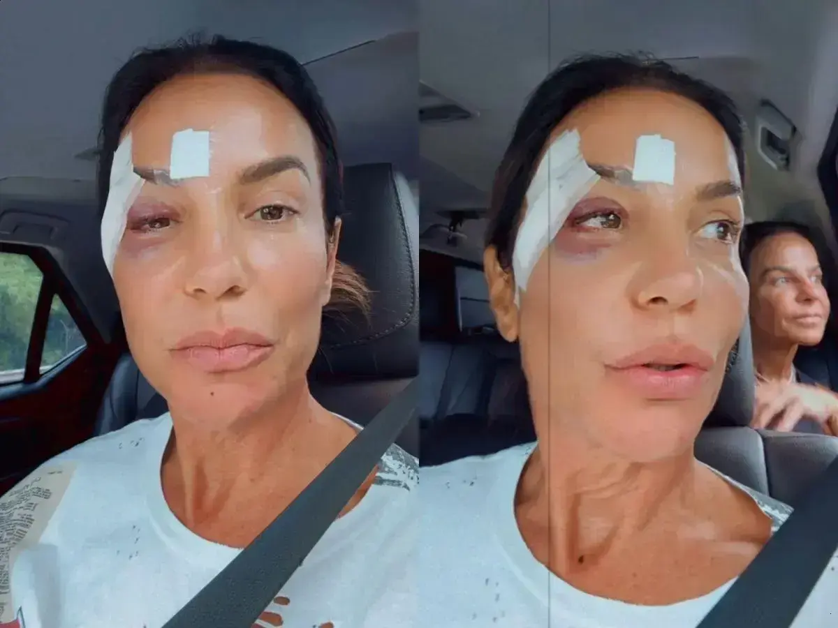Após alta hospitalar, Ivete Sangalo tranquiliza fãs sobre sua saúde