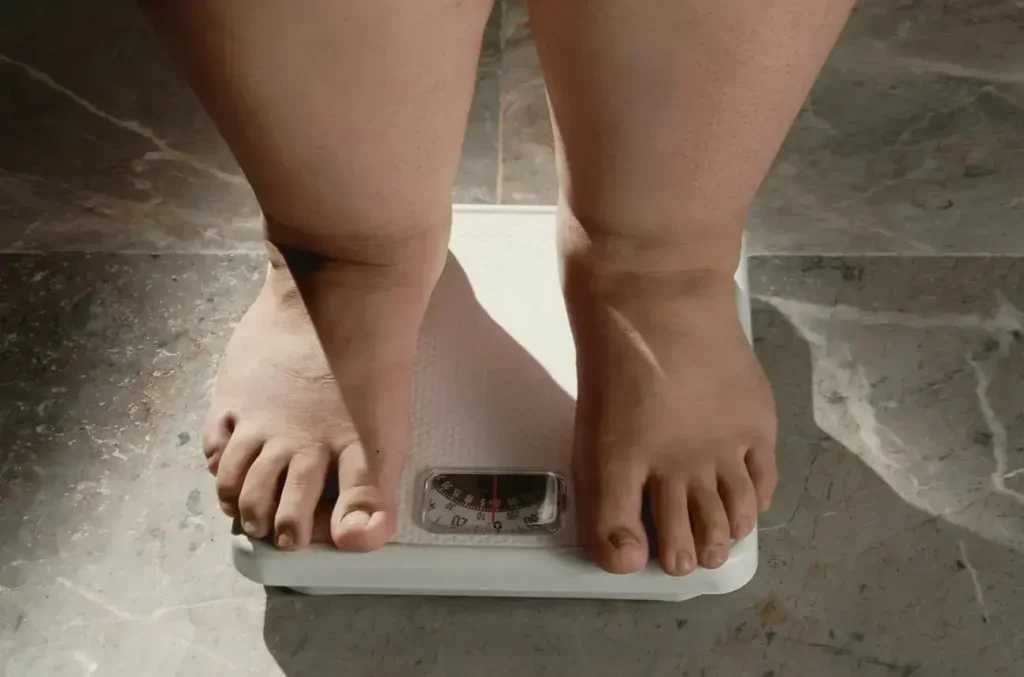 Crescimento da Obesidade no Brasil: Um Problema de Saúde Pública