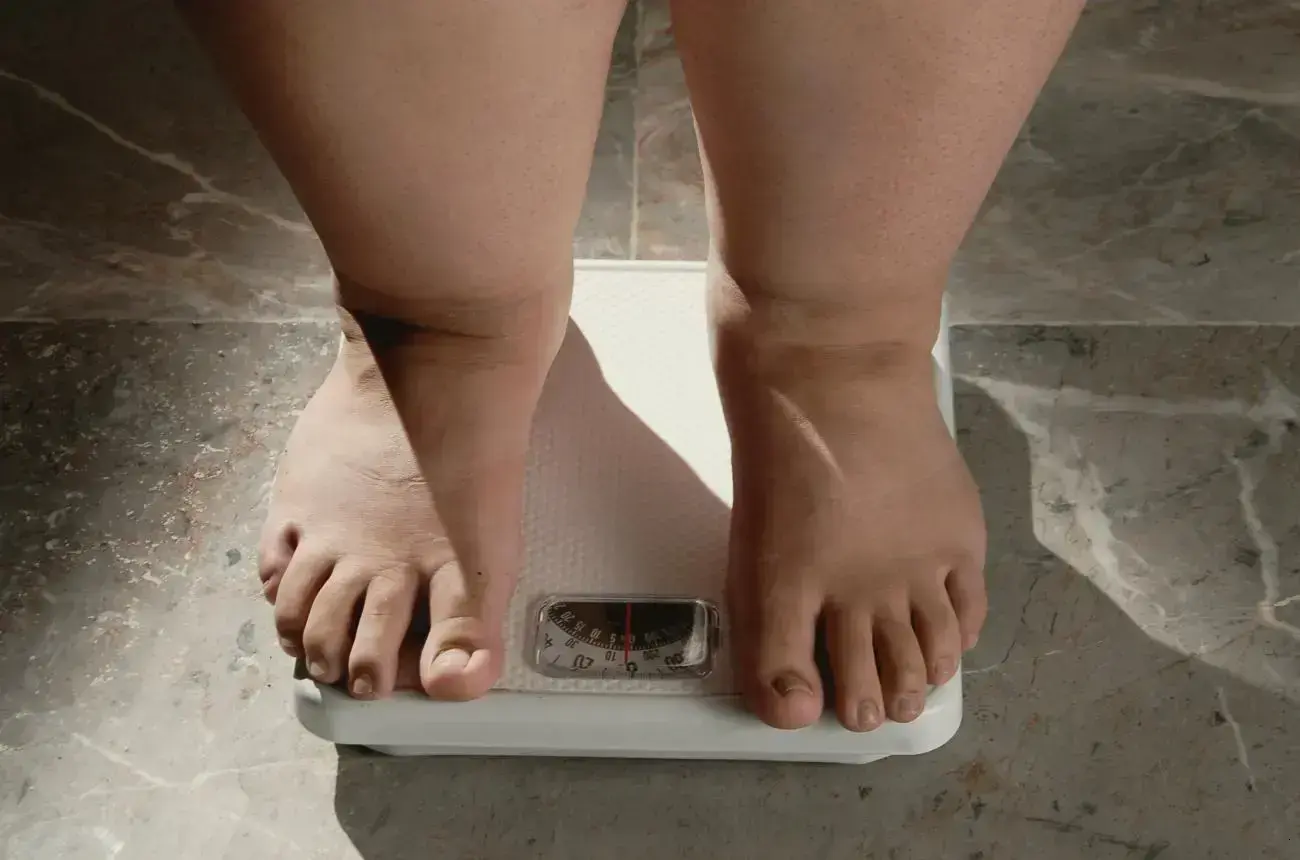 Crescimento da Obesidade no Brasil: Um Problema de Saúde Pública