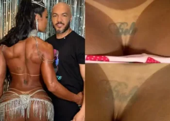 Gracyanne começa remoção de tatuagem íntima dedicada a Belo e viraliza
