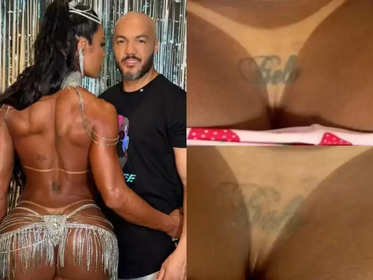 Gracyanne começa remoção de tatuagem íntima dedicada a Belo e viraliza