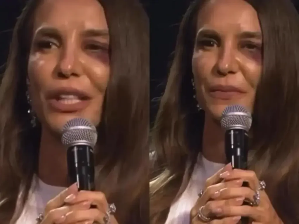 Ivete Sangalo confirma cirurgia para amanhã após susto recente