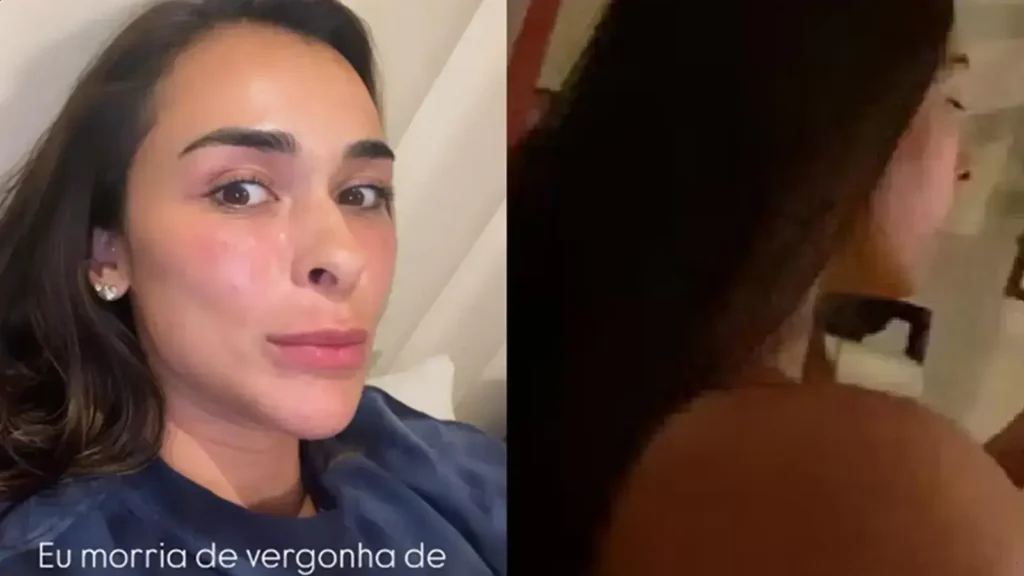 Tainá Militão revela antes e depois após perder quase 20 kg e desabafo