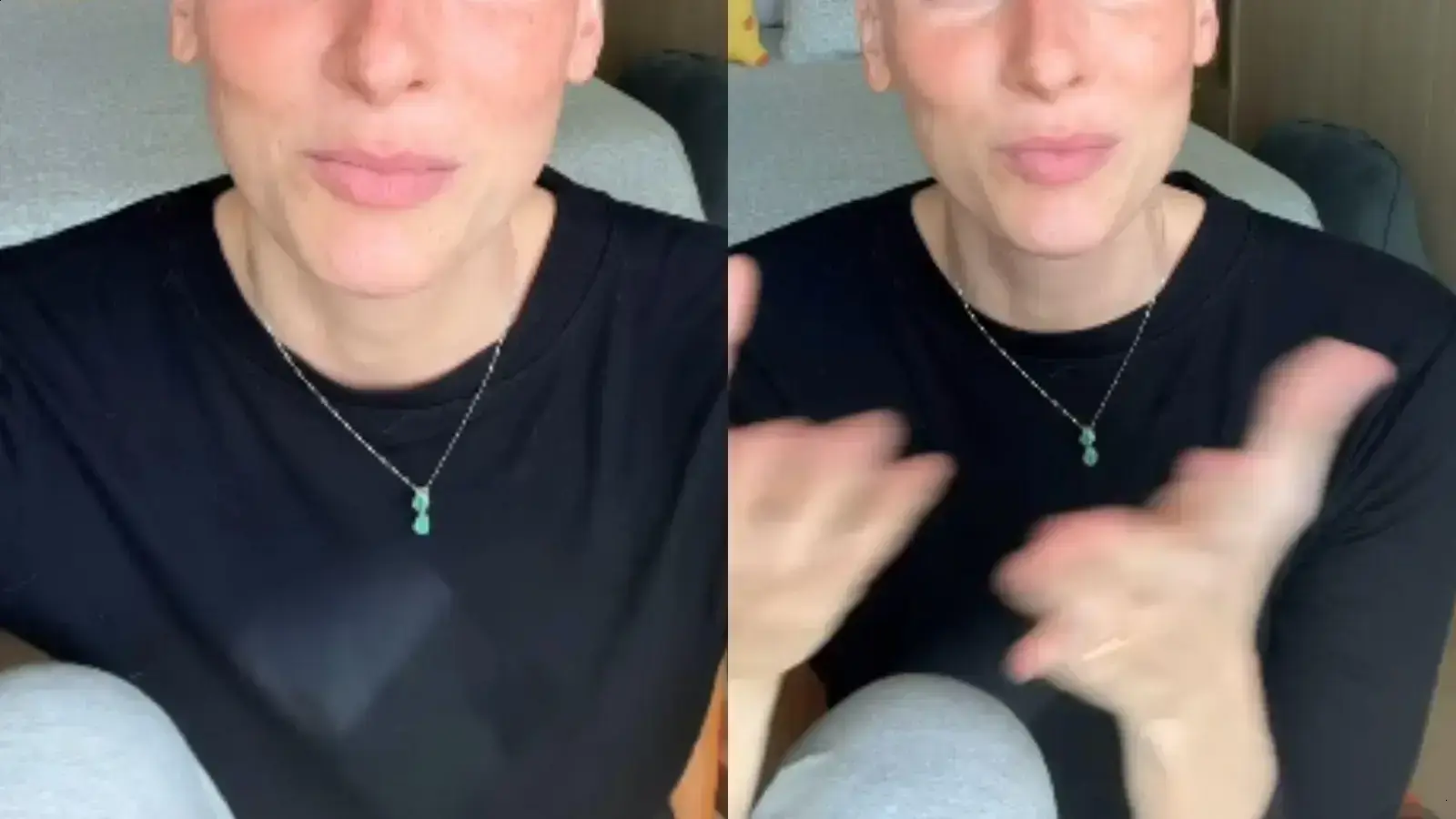 Dani Gondim abre sobre nova queda de cabelo após vitória contra o câncer