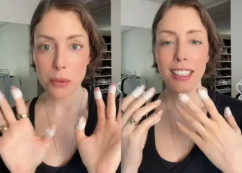 Fabiana Justus fala sobre sua luta contra a dermatilomania e bem-estar
