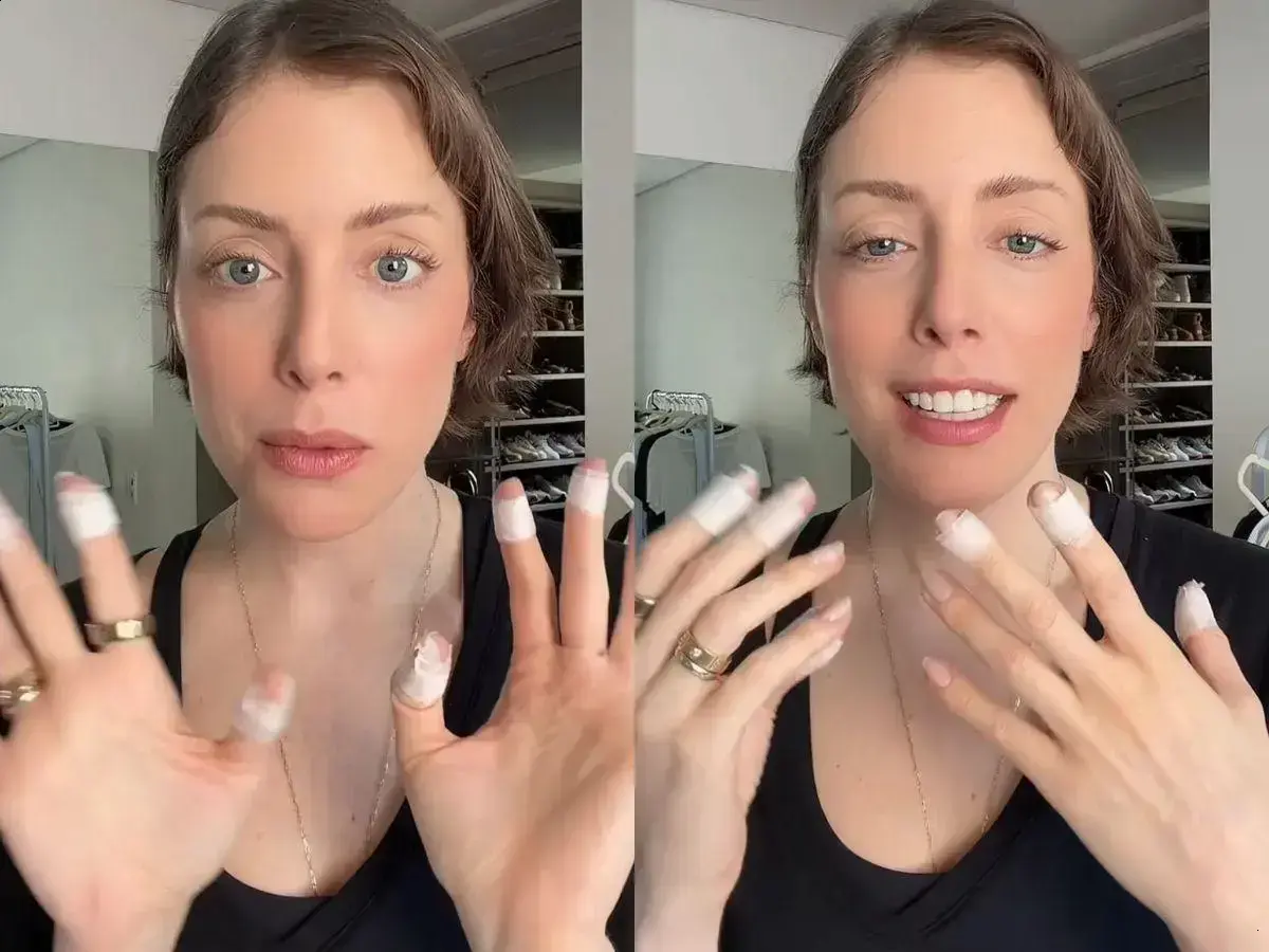 Fabiana Justus fala sobre sua luta contra a dermatilomania e bem-estar