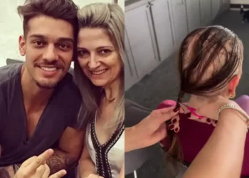 Karina Lucco compartilha nova fase após diagnóstico de alopecia areata