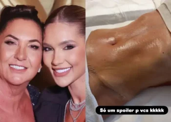 Margareth Serrão exibe barriga chapada após cirurgias plásticas e surpreende