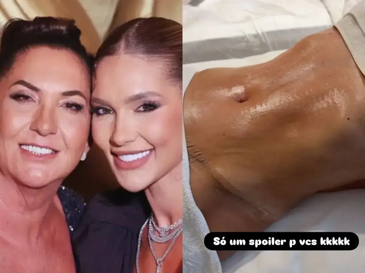 Margareth Serrão exibe barriga chapada após cirurgias plásticas e surpreende