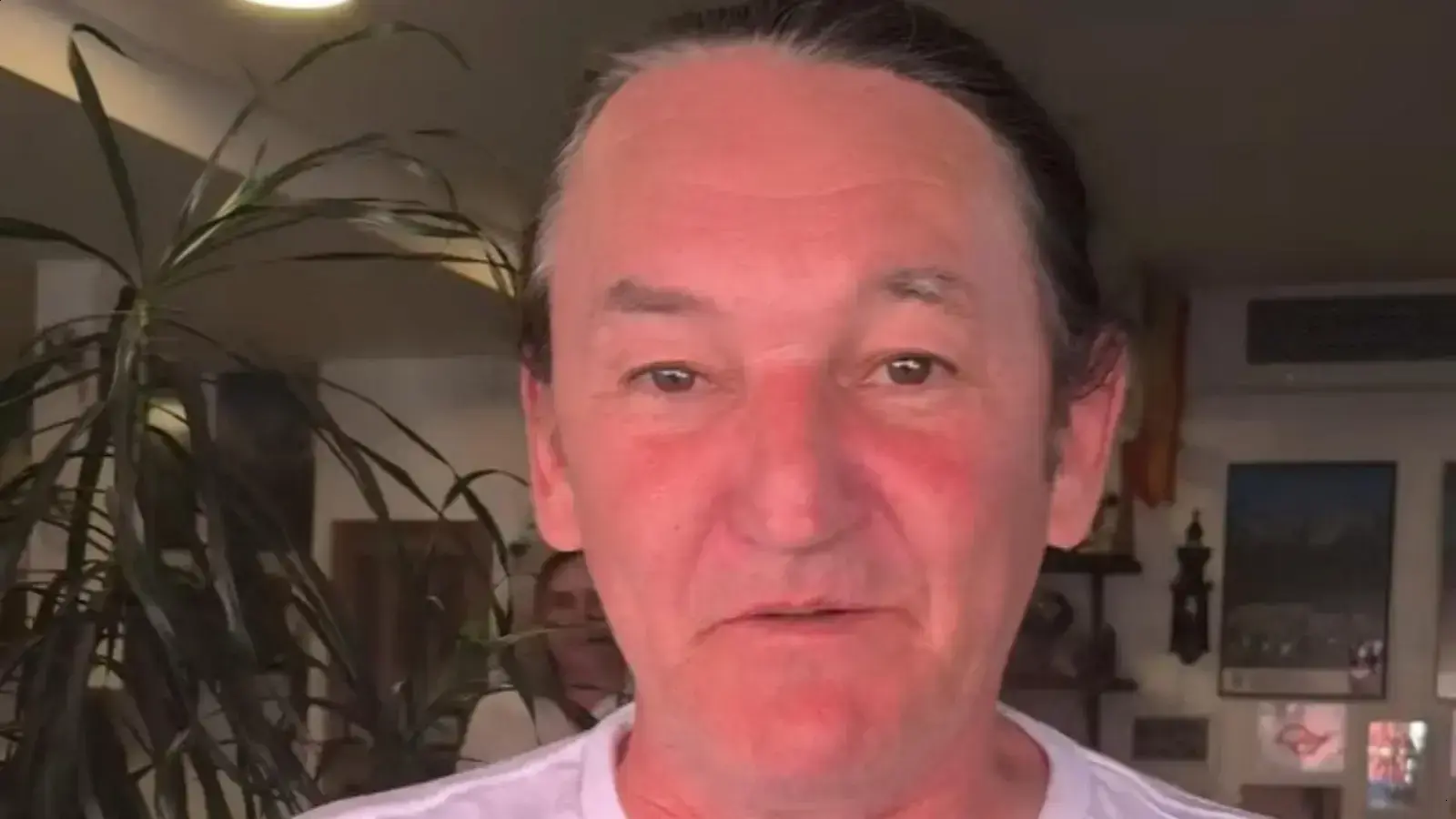 Marquito apresenta leve melhora após cirurgia e segue na UTI
