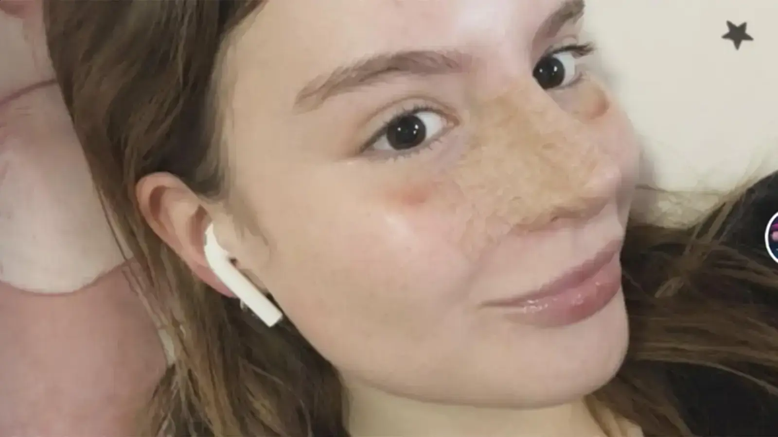 Sophia Valverde exibe novo nariz após rinoseptoplastia bem-sucedida