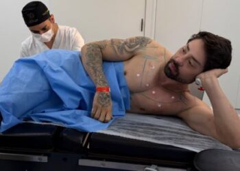 Rico Melquiades apresenta o inusitado “Cutox”, procedimento estético para a região anal