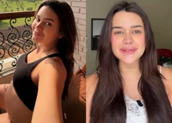 Franciny Ehlke responde a críticas sobre preenchimentos durante a gravidez e destaca: “É só uma fase”